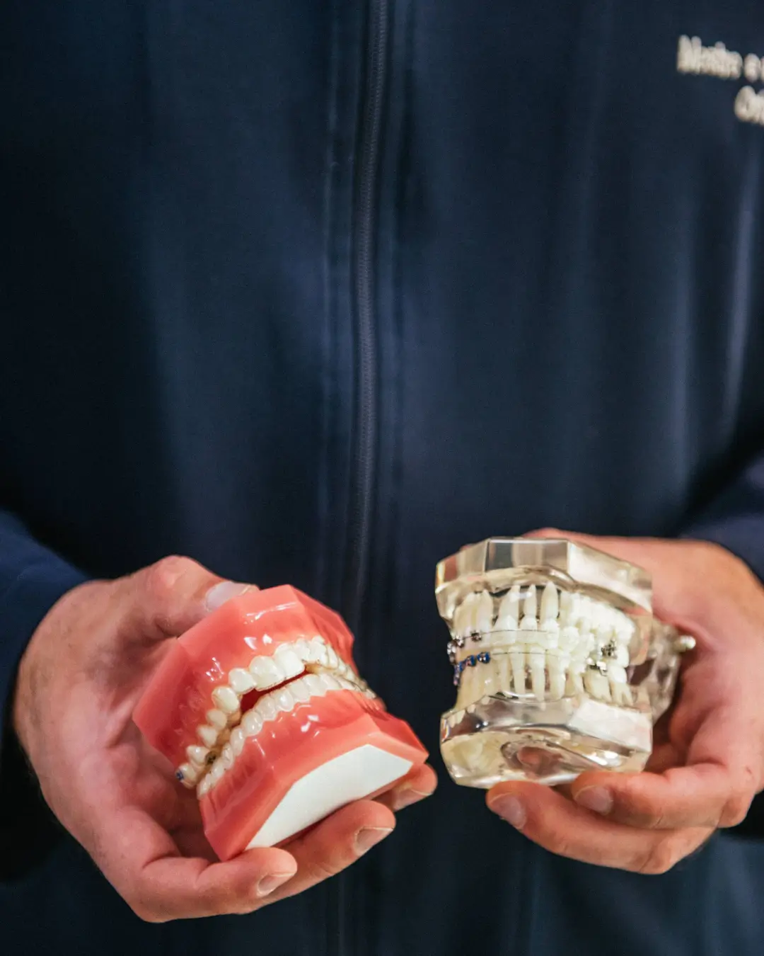 LOPES ORTODONTIA, APARELHO FIXO EM FORMIGA, INVISALIGN EM FORMIGA, LOPES ORTODONTIA FORMIGA, DENTISTA EM FORMIGA, APARELHO EM FORMIGA, DENTISTA INFANTIL EM FORMIGA (46)